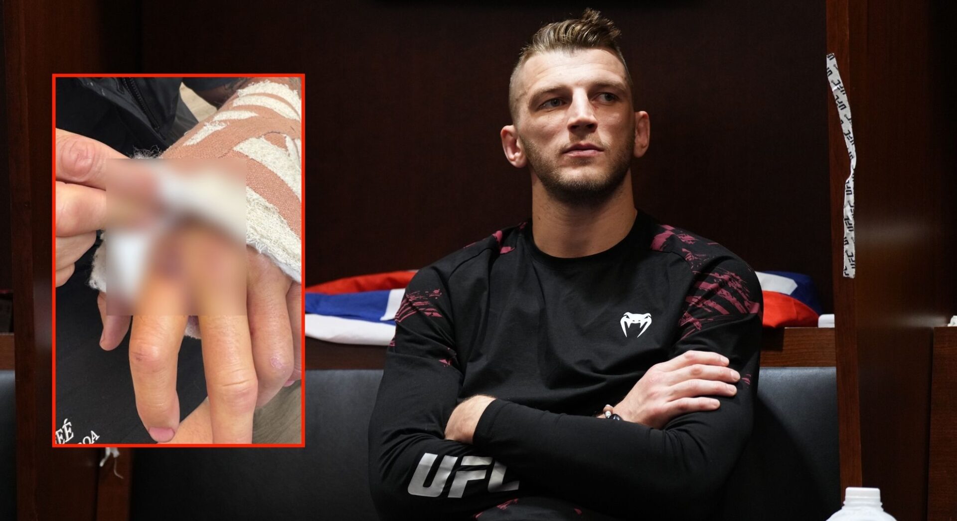 Preview Dan Hooker Shares Grisly Hand Surgery Stitch Removal Video