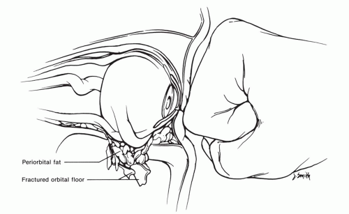 Preview Maxwell’s Misfortune: Fractured Wrist Disrupts Australia’s T20 Blueprint