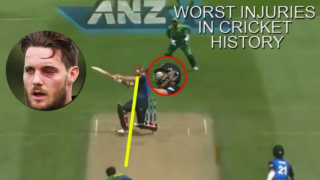 Preview A New Chapter in Cricket: When an Injury Opened the Door to History