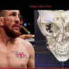 UFC Bantamweight Merab Dvalishvili Out for Up to a Year After Devastating Training Injury
