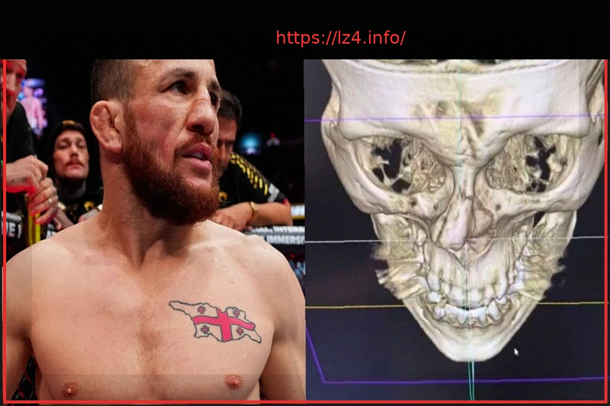 Preview UFC Bantamweight Merab Dvalishvili Out for Up to a Year After Devastating Training Injury